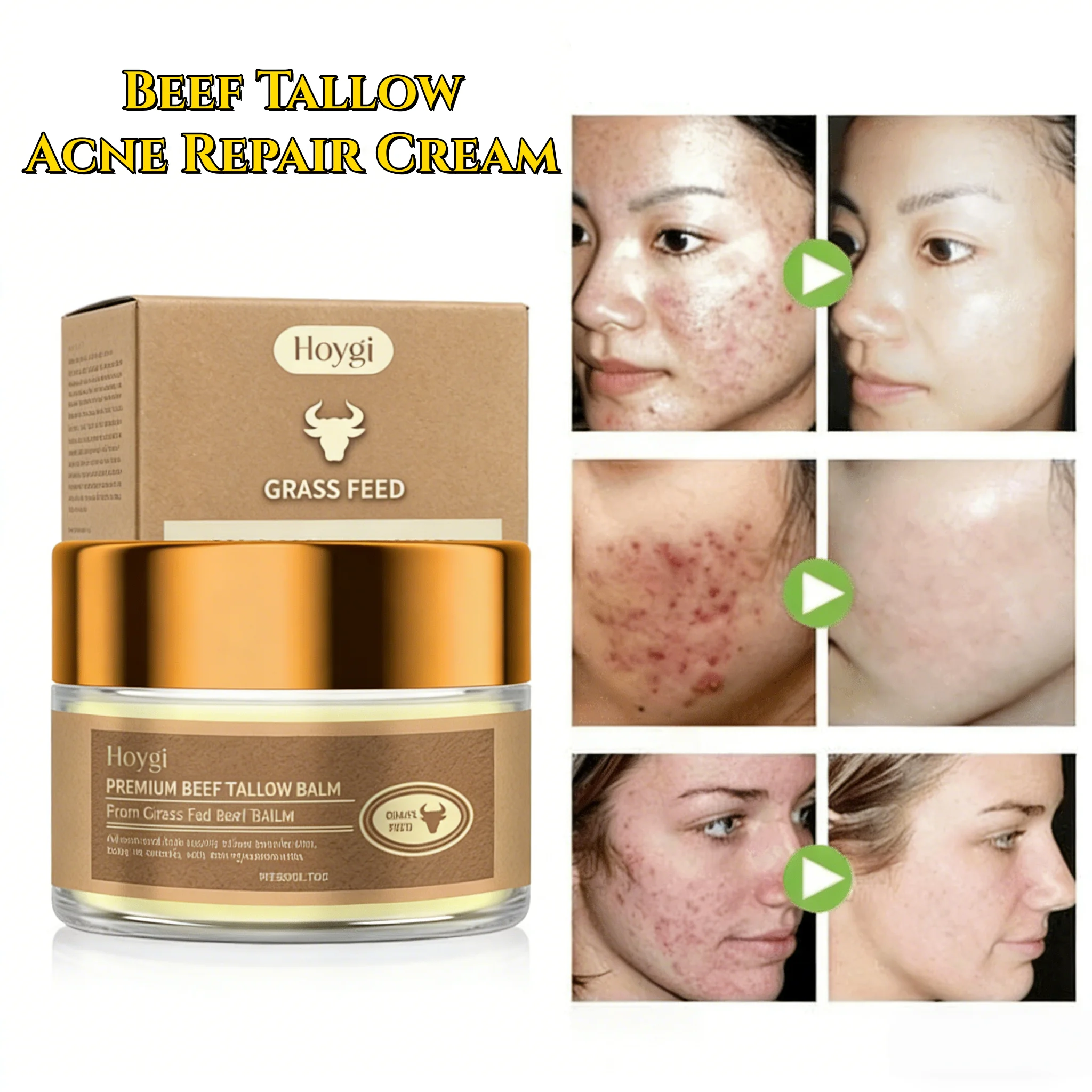 

Крем-бальзам для лица с говяжьим жиром: восстановление кожи, увлажнение, повышение эластичности, разглаживание, питание, от акне