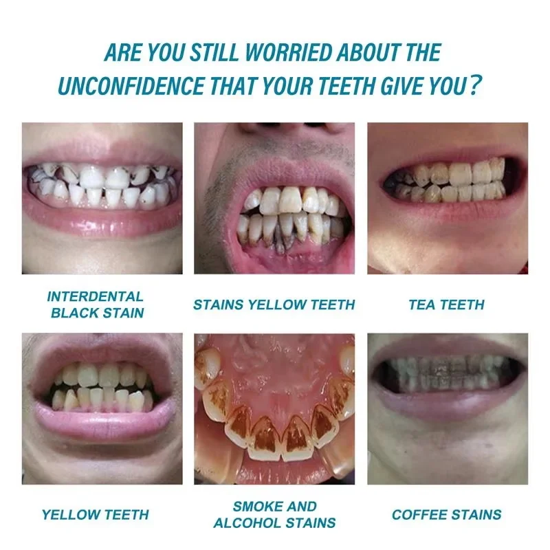 

Teeth Whitening Essence Remove Plaque Stains Serum Fresh Breath Oral Hygiene Against Dental Caries Dental Tooth Cleaning 10ml