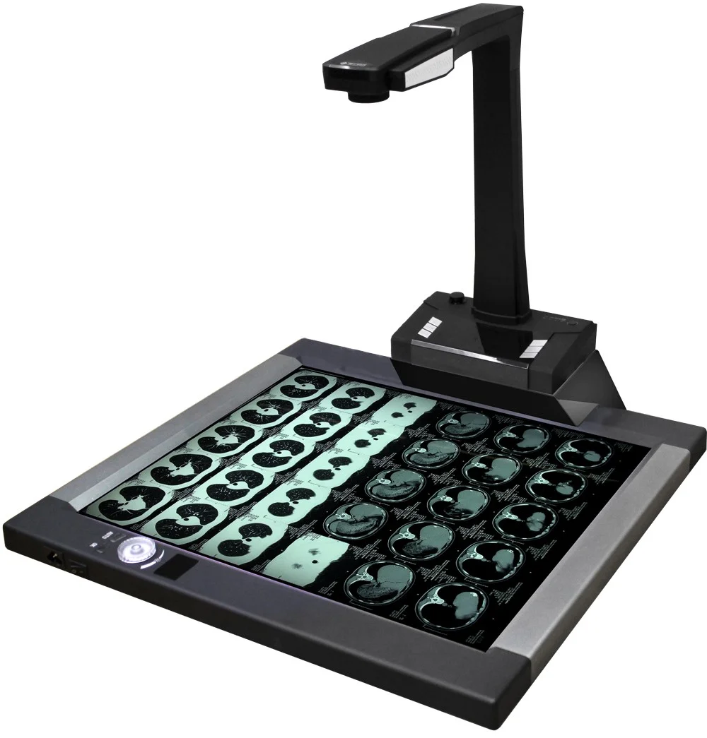 CT160 16MP High Brightness Adjustable Medical X-ray Film Scanner and Viewer CT Scanner Medical LED Negative Film