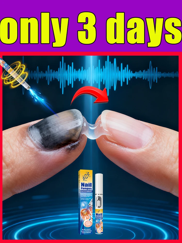 

We eliminate nail fungus and help you regain confidence in your hands and feet. From Tokyo to New York, from London to Sydney