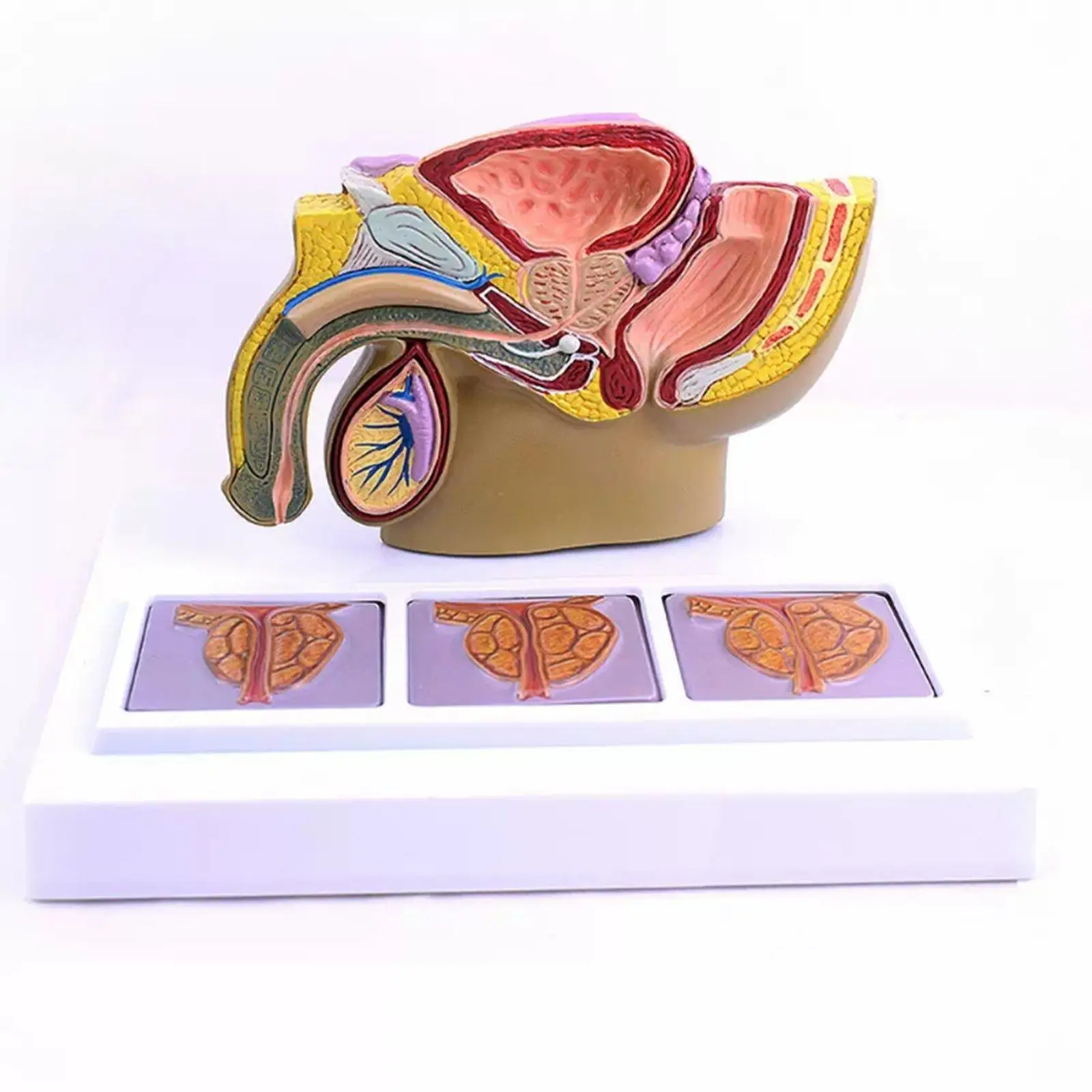 PVC Human Male Pelvis Prostate Pathology Sagittal Section Model Medical Teaching Models