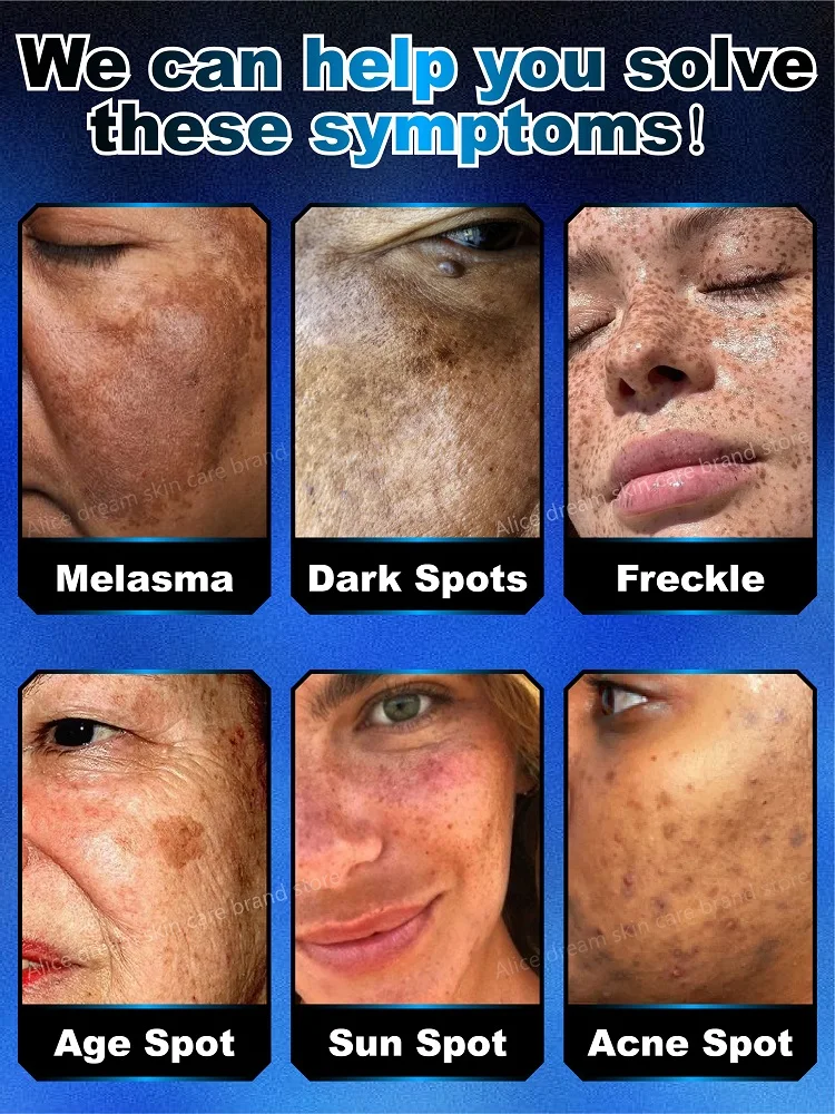 Effectively solves all pigmentation symptoms