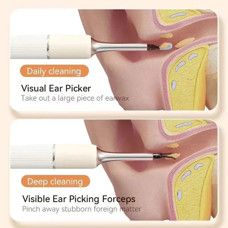 Detergente per le orecchie senza fili bastoncini per la rimozione del cerume visivo intelligente endoscopio a cera WIFI 8MP HD detergente per le