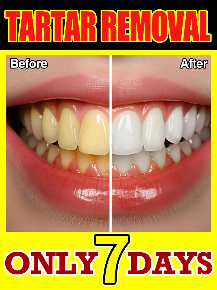 

2025 New high-tech teeth whitening to remove tartar
