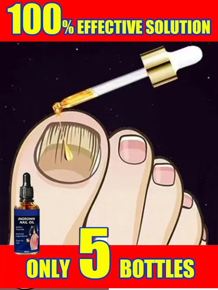 Zestaw do pielęgnacji paznokci 3ND Nail Nourish Technology Serum, narzędzia można kupować pojedynczo lub w połączeniu.