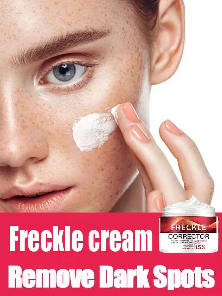 Anti-Freckle Skin Whitening Cream Removes Melanin Dullness Reduces Age Spots Freckles Facial Moisturizing Brightening Face Care