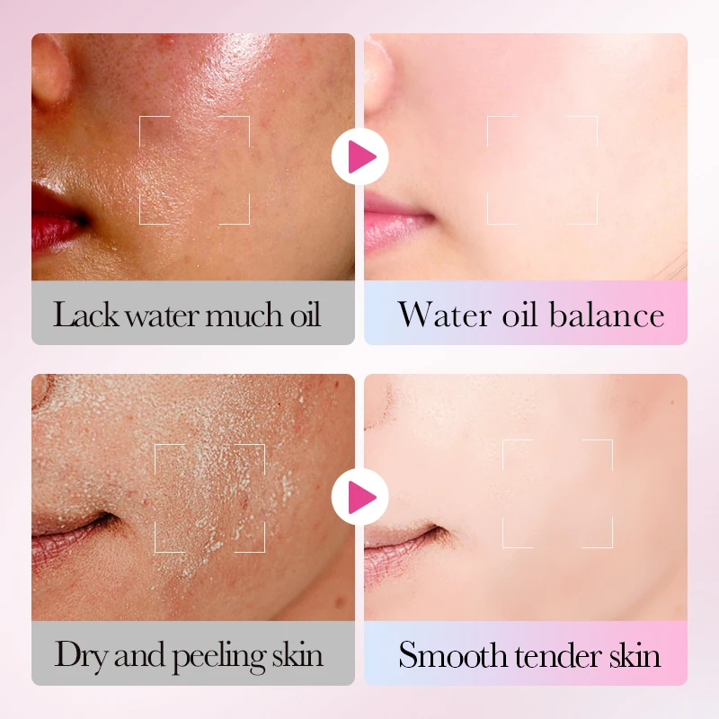 BIOAQUA مانجو كريم وجه ترطيب تبييض مكافحة الشيخوخة المضادة للتجاعيد كريم وجه منتجات العناية بالبشرة الوجه