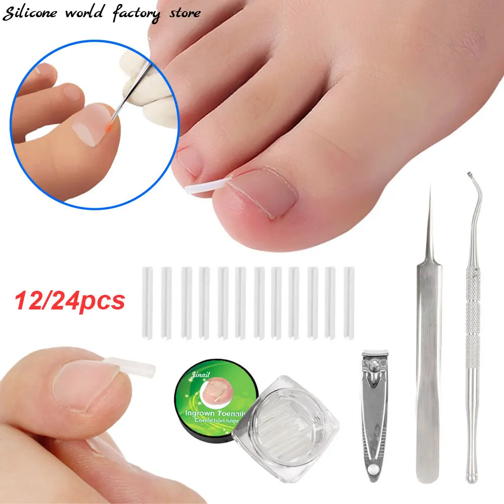 Silicone World 12/24pcs Ingrown Nail Corrector C-shaped Filling Pad For Nail Inlay Pedicure Correction Tool Sleeve Slot Clippers