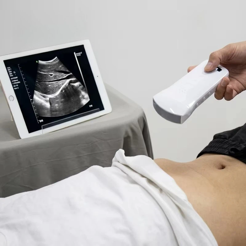 Convex 128 Elements Wireless Probe Portable Ultrasound Scanner Price Veterinary Ultrasound Scanner