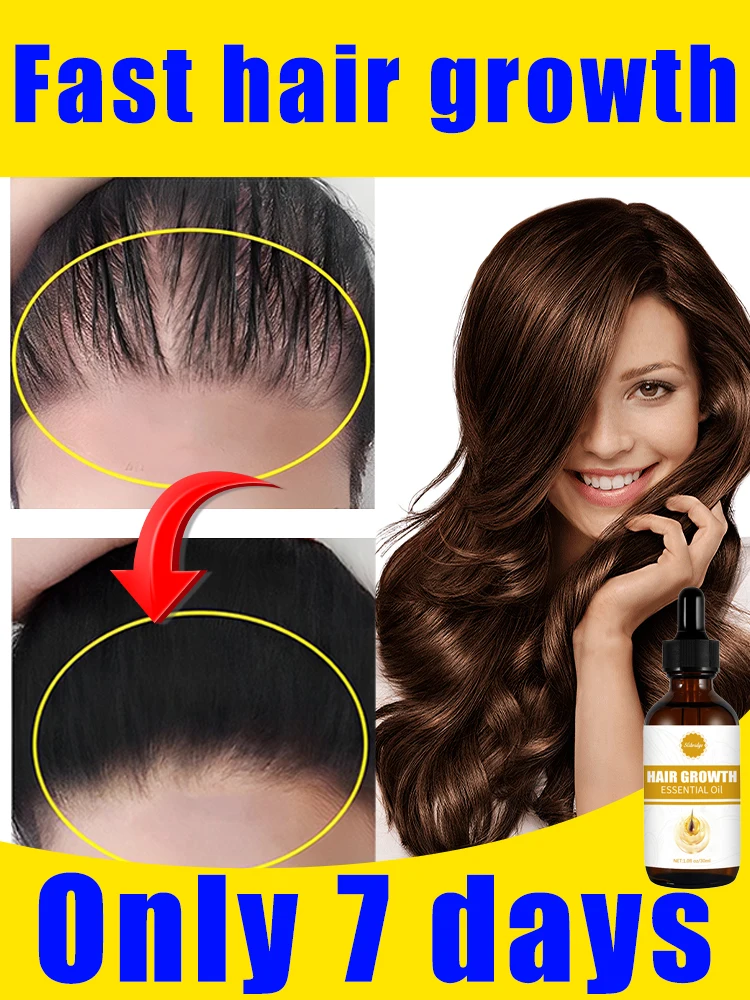 

7 Day Fast Hair Growth Oil Ginger Growth Hair Treatment Anti Hair Loss