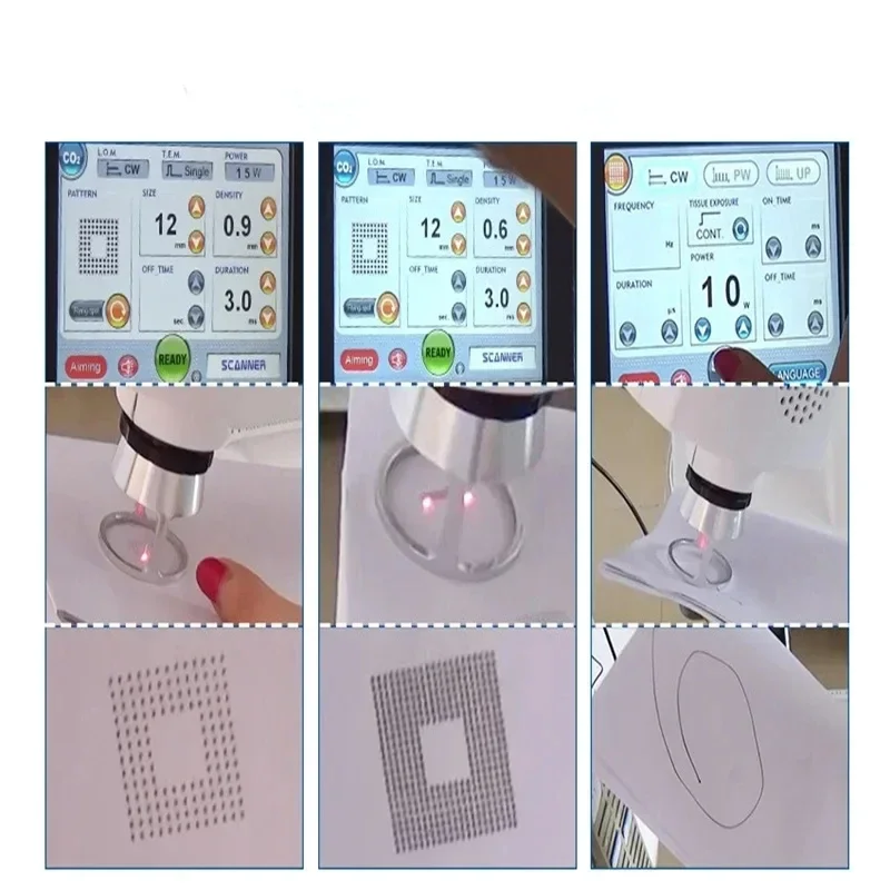 เครื่องเลเซอร์สลาย Co2 4D fotona เครื่องรักษา10600nm เลเซอร์เครื่องความงามสำหรับผิวรอยแผลเป็นจากสิวดีไซน์ใหม่ล่าสุด