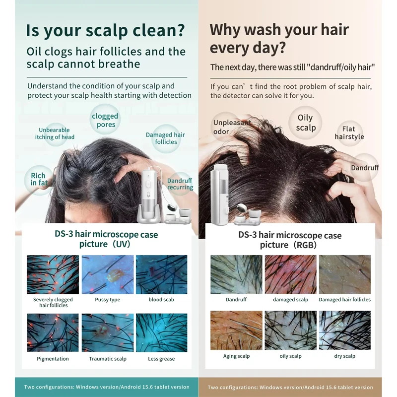 Détecteur de fuite de cheveux HD, Scanner de cuir chevelu, prévention de la perte de cheveux, analyseur de miroir capillaire, dispositif d'analyse de détection professionnel