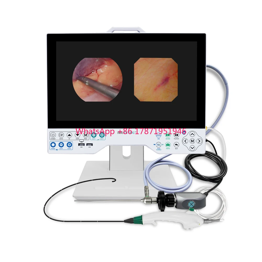 15.6 inch display Full HD All in one Endoscope camera  System with Light source for laparoscopy Urology ENT