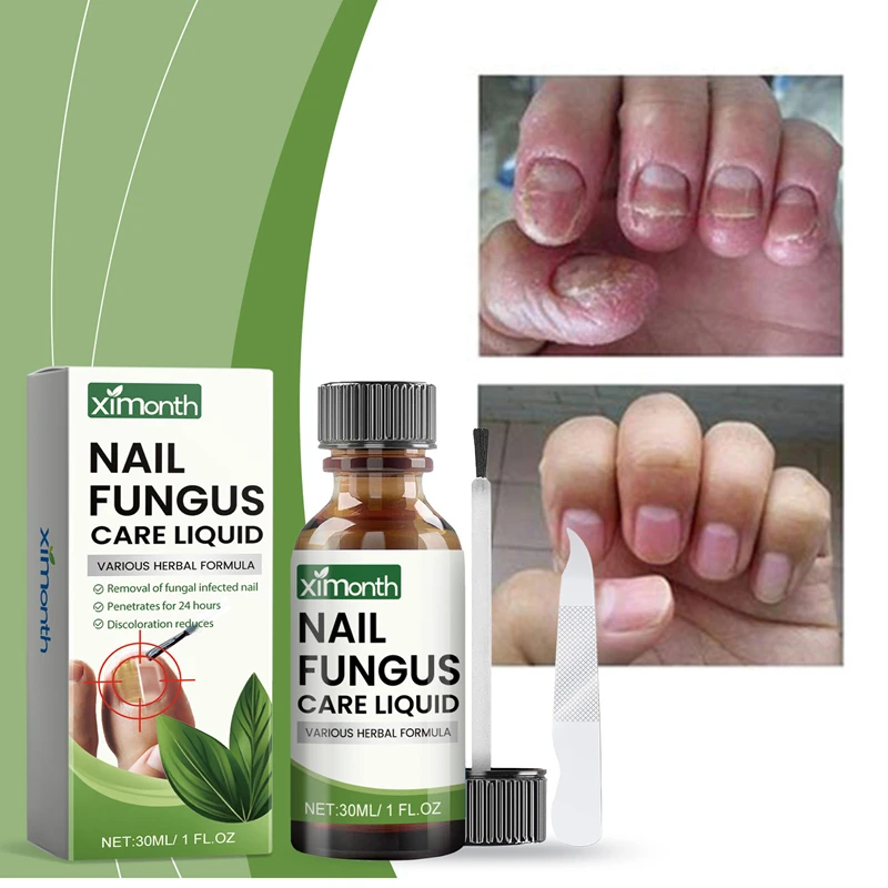 

Nail Care Liquid Kit 1 Set Nail Strengthening Care Liquid with Nail File Nail Care Product for Women & Men Nail Supplies