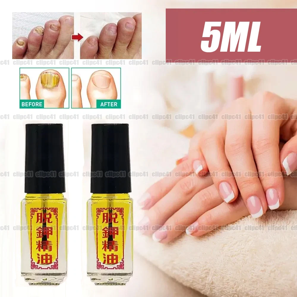 1Piece 3 Days Effect Really Work Nail Treatment Removal of Onychomycosis Paronychia Anti Oil Fungal Nail 5ml