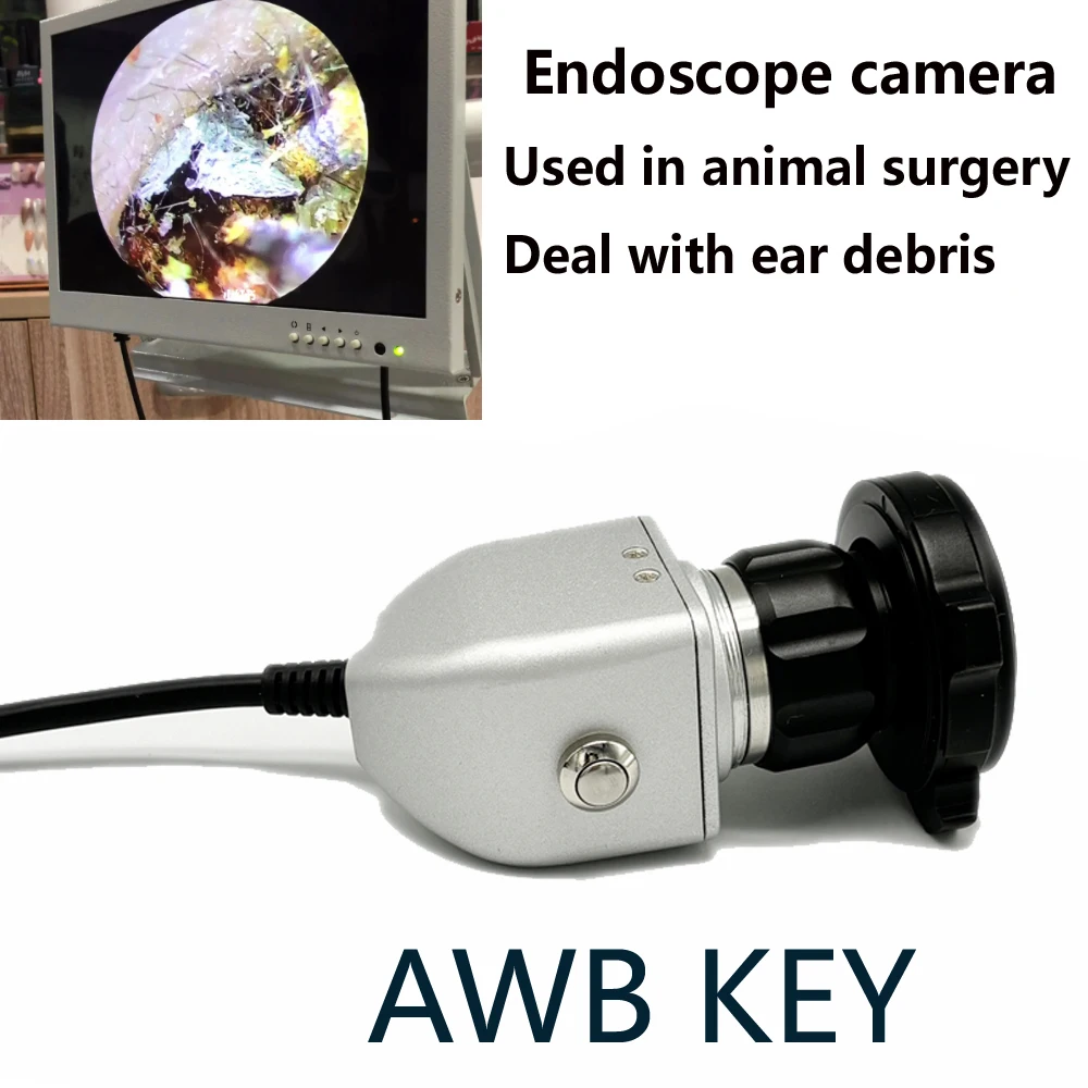 AWB Key Medical CCD Endoscope Camera ENT Inspection with F22mm Coupler Connect Monitor Ear Endoscopic Camera Digital Mini ENT