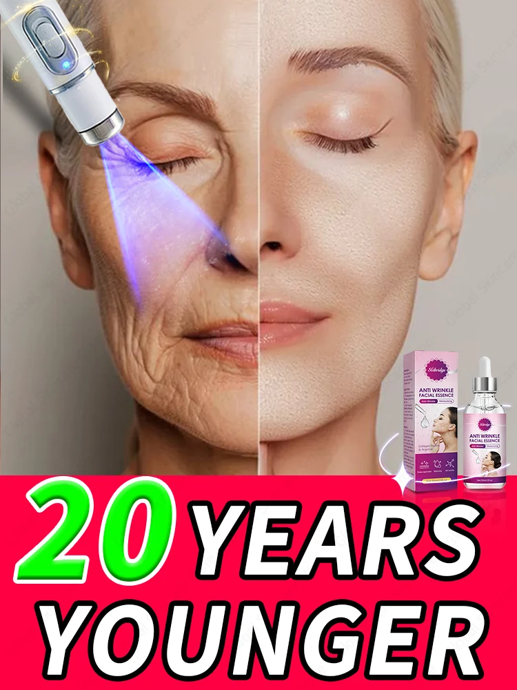 

20 years younger
