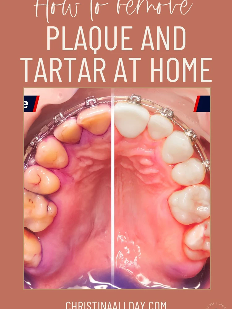 

V34 Dental Whitening Toothpaste Instant Teeth Whitener Cleaning Tooth Stain Tartar Removal Tongue Cleaner Oral Hygiene Fresh Bre