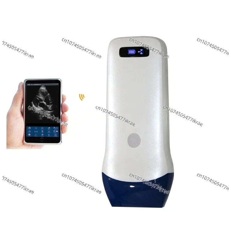 Linear Probe 3D 4D Color Doppler Ultrasonido Machine Wireless Wifi Portable Ultrasound Scanner