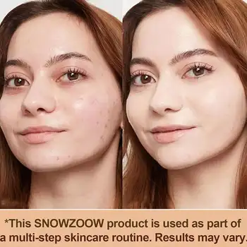 포에버 블룸 4 in 1 바이오미믹 파운데이션, 피부 재생 프라이머, SPF50+ 자외선 차단 세럼, 보습 미디엄 풀 커버리지 컨실러 12 best sales 메이크업 포에버 - №5