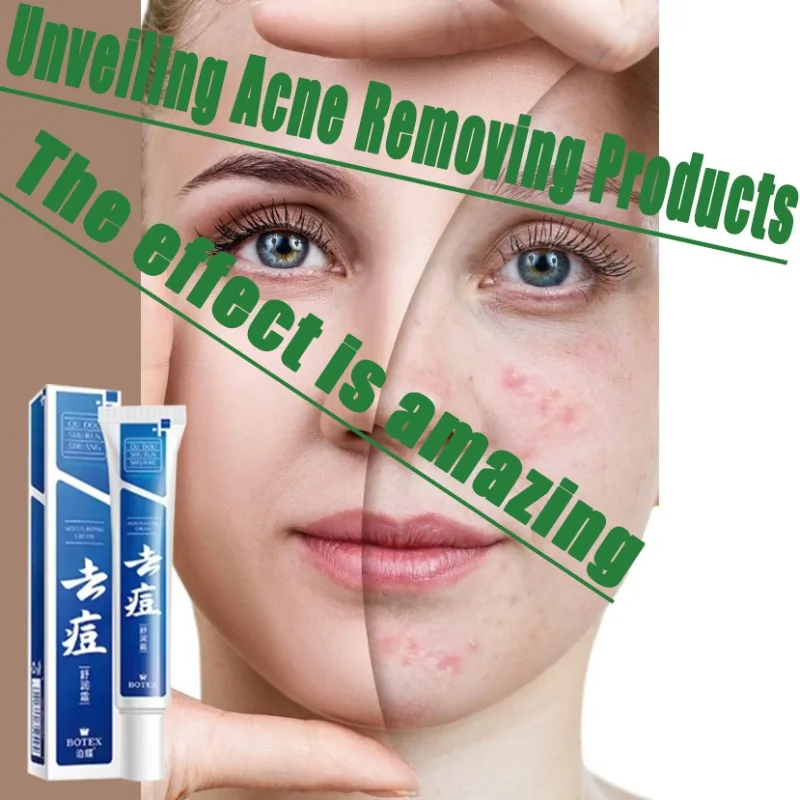 

Anti acne facial essence, acne removing and smoothing skin, collagen protein, hyaluronic acid essence oil, skin care cosmetics