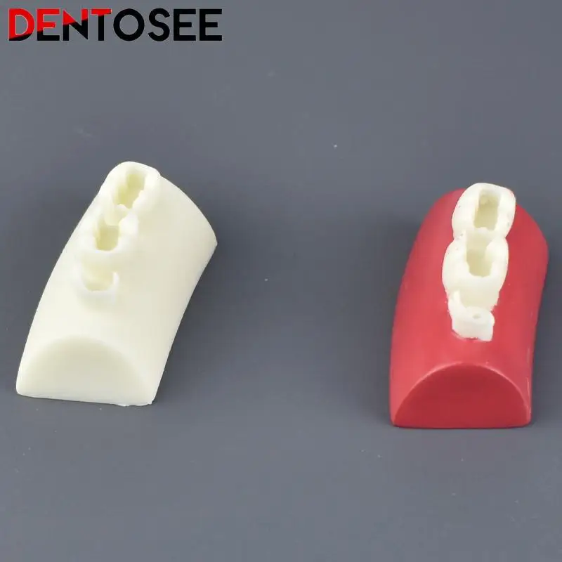 

Inlay Exercise Model Dental Typodont Model Filling Exercise Resin Block Red White Dentistry Materials Tool