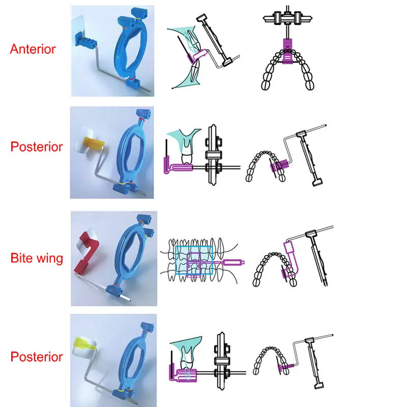 1 zestaw zestawu do pozycjonowania czujnika dentystycznego w System pozycjonowania do wewnątrz jamy ustnej