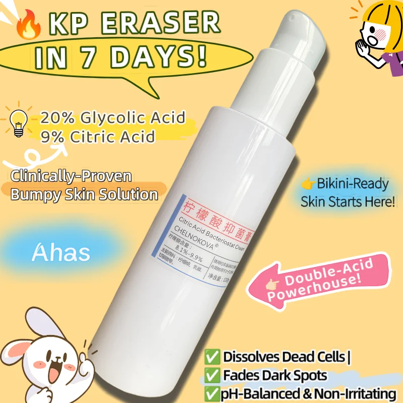 Double Acid Body Lotion - Glycolic & Citric Acid Formula, Improves Skin Texture, Reduces Roughness & Uneven Tone, For Women Men