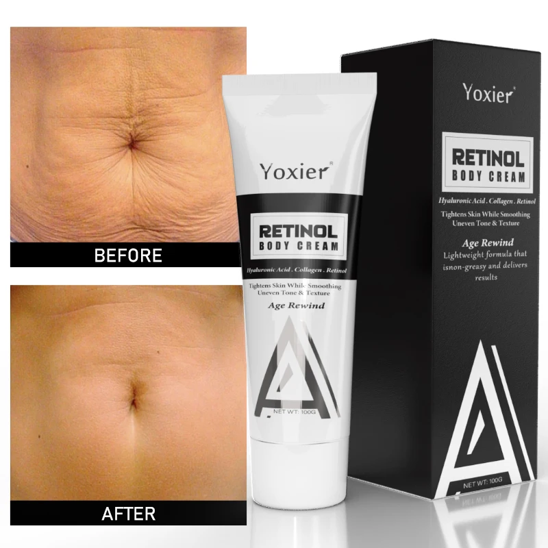 Retinol Body Cream Remove Cellulite Shaping Moisturizing Tightening Firming Lift Improve Sagging Skin Nourish Body Care 100g