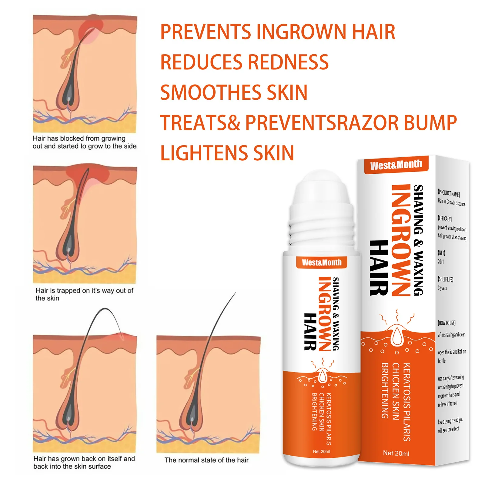 Ingrown Hairs Treatment Serum, Dark Spot Reduction