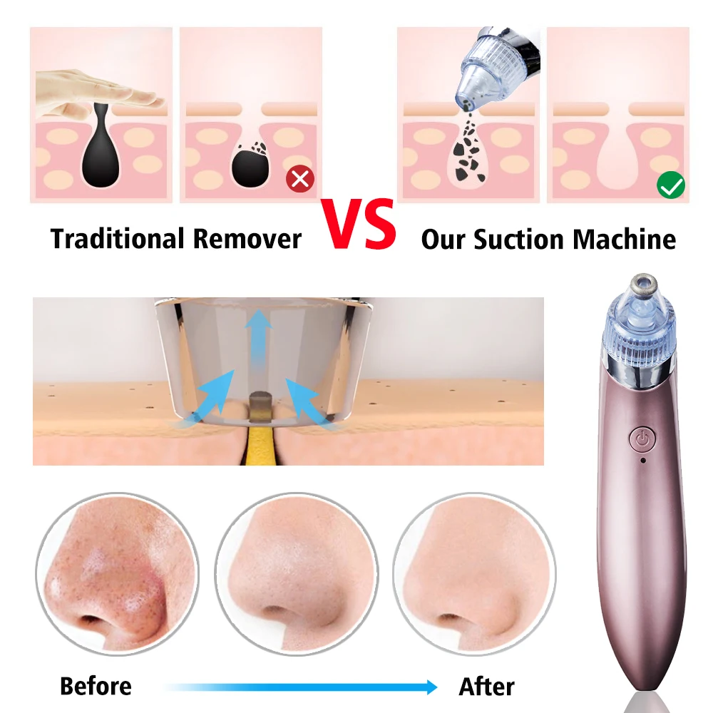 Face Skin Care Electric Blackhead Remover Household Gadget Facial Cleaning Tools Microcrystal Pore Cleaner Beauty Appliances