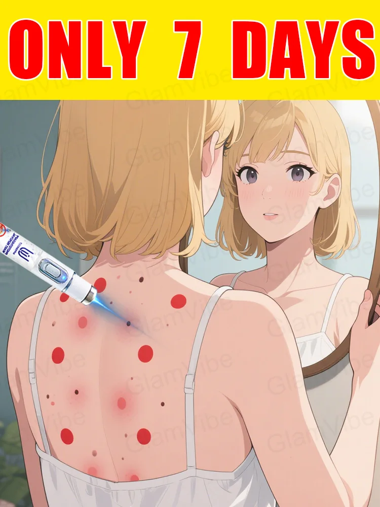 

blue light pen solve warts, hot sale wart care tools