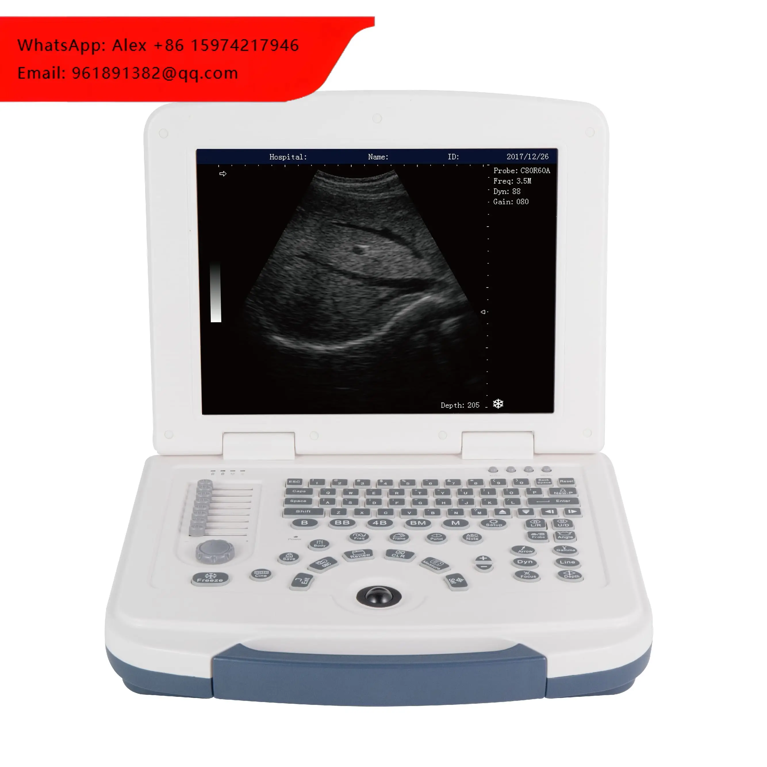 RC-BW580 Cheapest Portable Veterinary Ultrasound Scanner Machine Of Good Price
