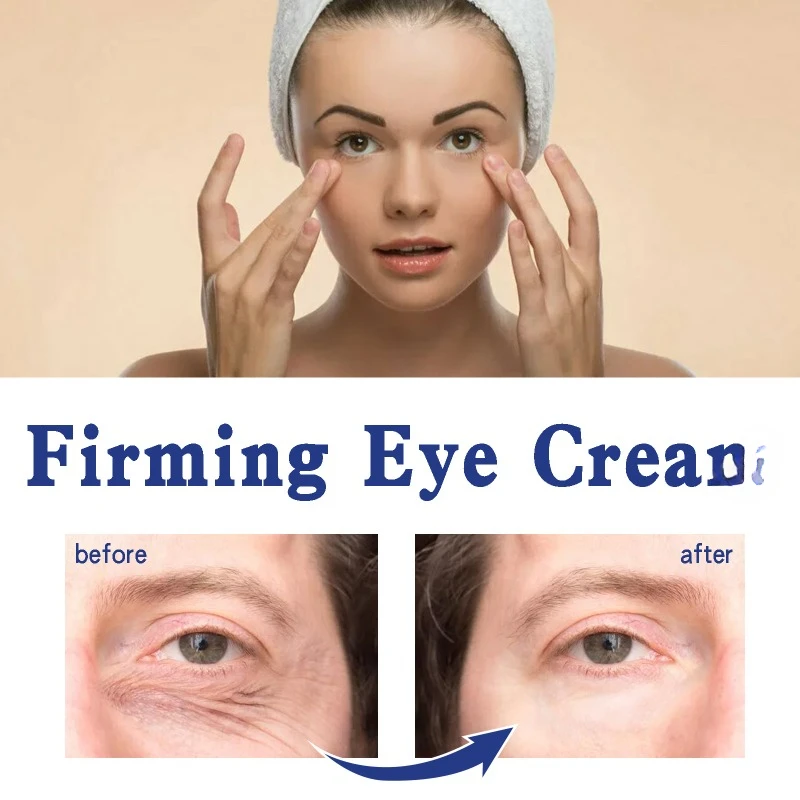 Crema para eliminar las bolsas de los ojos, antiojeras, hinchazón, mejora las arrugas, antienvejecimiento, hidratante, desvanecimiento, líneas finas, masaje, cuidado de la piel