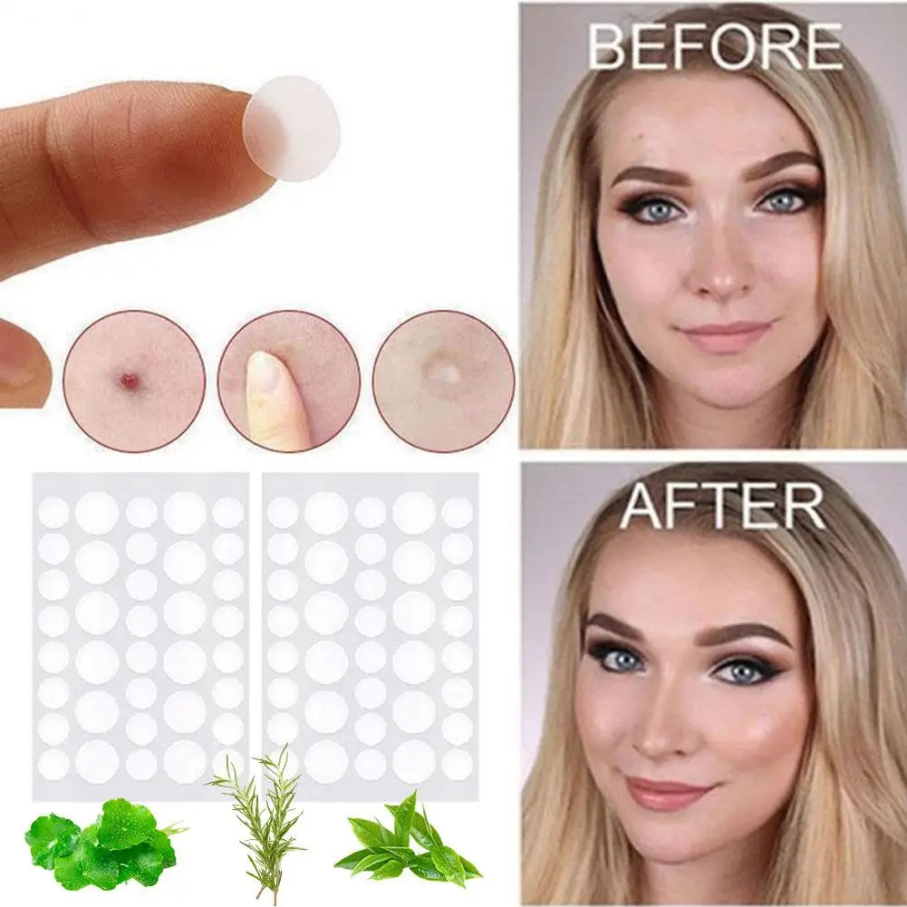 Patch autocollant imperméable pour le traitement de l'acné, outil de suppression des boutons, masque facial anti-taches, soins de la peau, 72 pièces