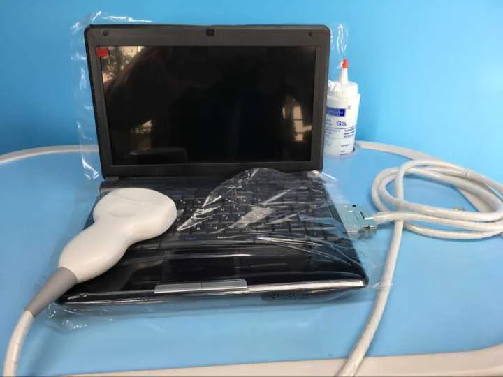 Digital Laptop Veterinary Mini Ultrasound  SUN-806F Price