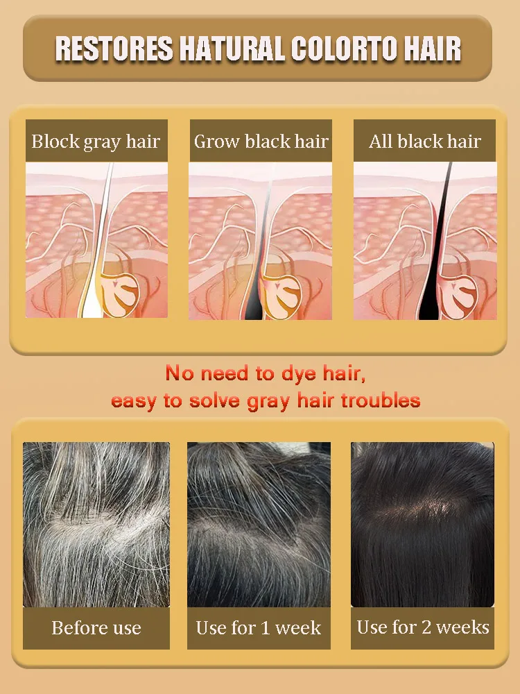 Anti Gray Hair Serum Gray Hair Treatment Remedy White Darkening Products