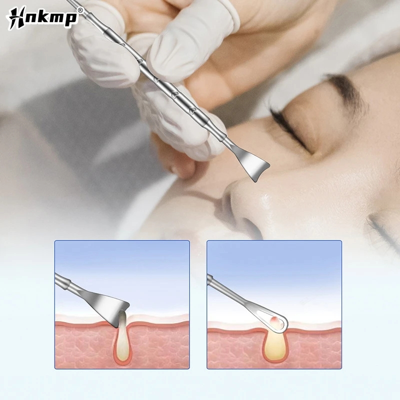 2 In 1 Pimple Popper Tool Blackhead Remover Acne Needle Removing Treatment Whitehead Popping Zit Nose Face Blemish Extractor