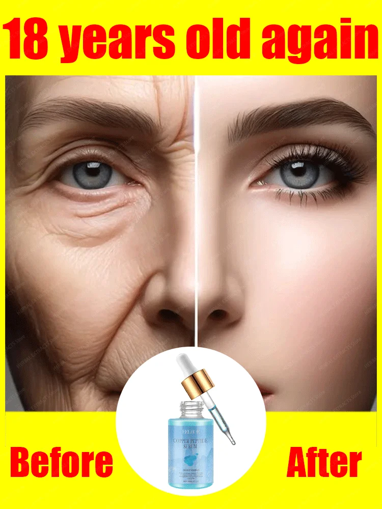 

wrinkles to Say goodbye