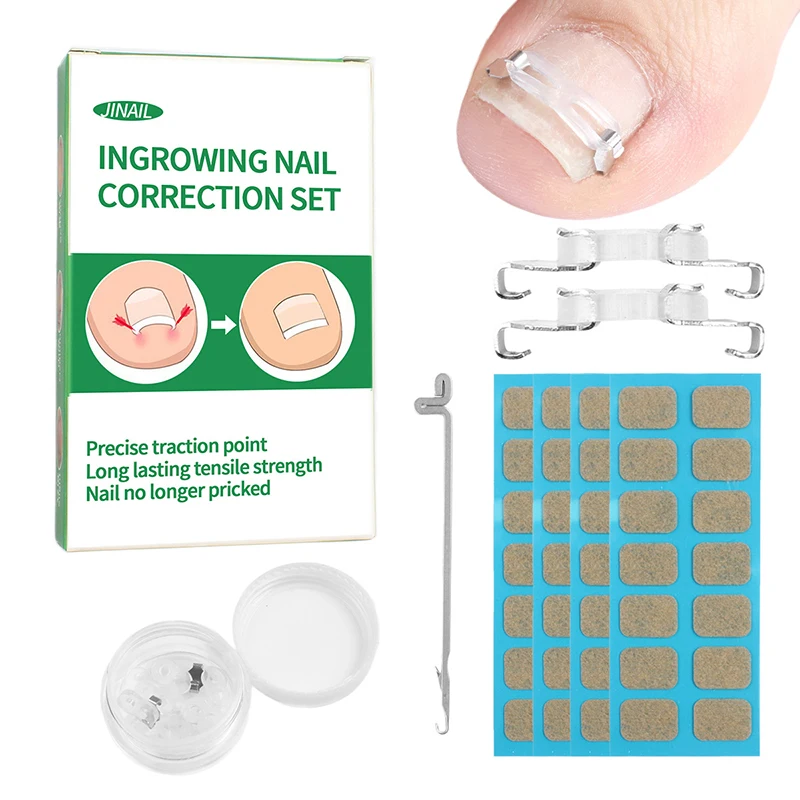 Caldo! 1/2 Set Strumenti per la correzione dell'unghia del piede incarnita Pedicure Recupera il trattamento dell'unghia del piede incorporato Strumento professionale per la correzione della cura del piede