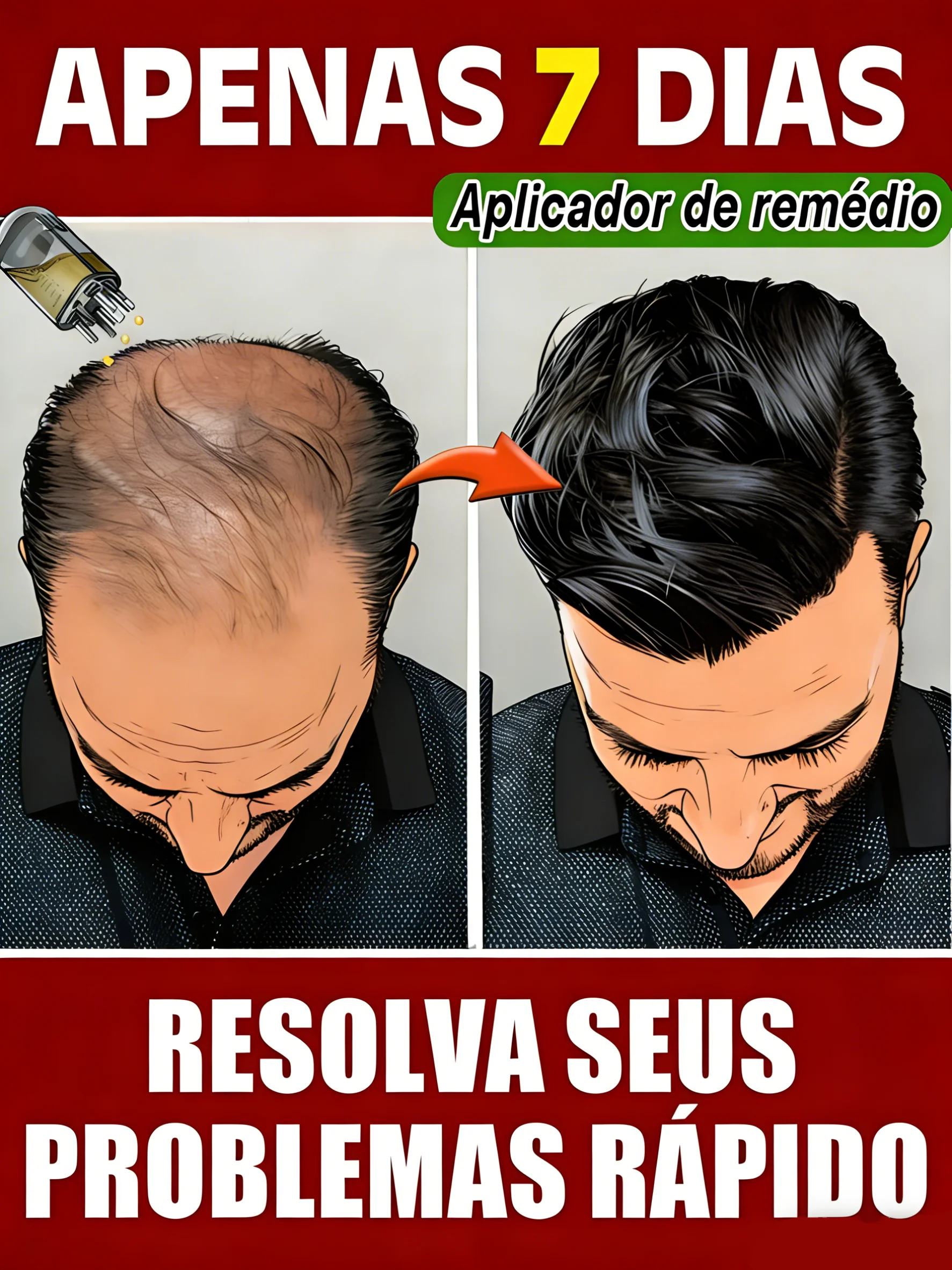 spedizione-gratuita-aiuta-le-persone-che-danneggiano-i-follicoli-piliferi-risolve-i-loro-problemi-vendita-calda-strumenti-di-riparazione-unisex-vendita-calda-nel-2025