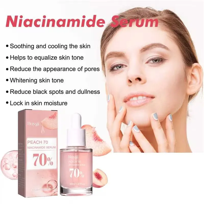 Nicotinamide siero viso rimozione macchie scure Acne Brighten Essence restringimento dei pori rassodamento idratazione profonda cura della pelle del