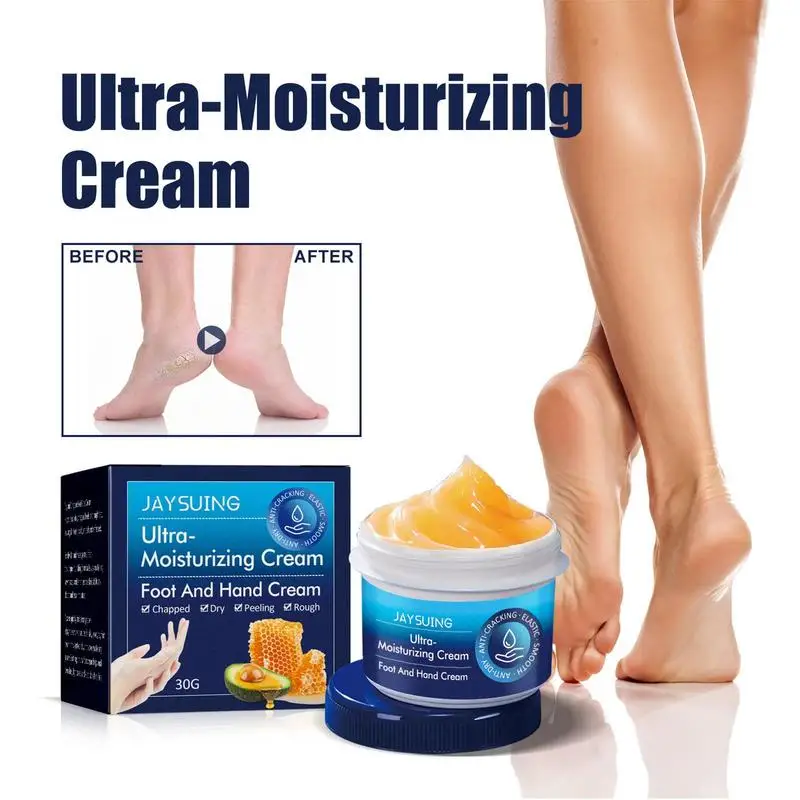 Crema per le mani Pelle estremamente secca e screpolata Crema per le mani e i piedi Crema per le mani ricchezza e vellutata Rinfrescante e non grassa Rifornimente