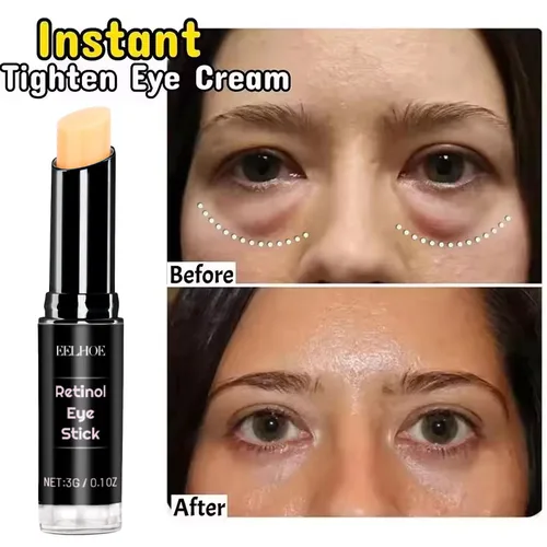 Crema de eliminación instantánea de bolsas de ojos, colágeno, antiarrugas, decoloración de líneas finas, reafirmante de la piel, anticírculo oscuro, hinchazón, ilumina el cuidado de los ojos