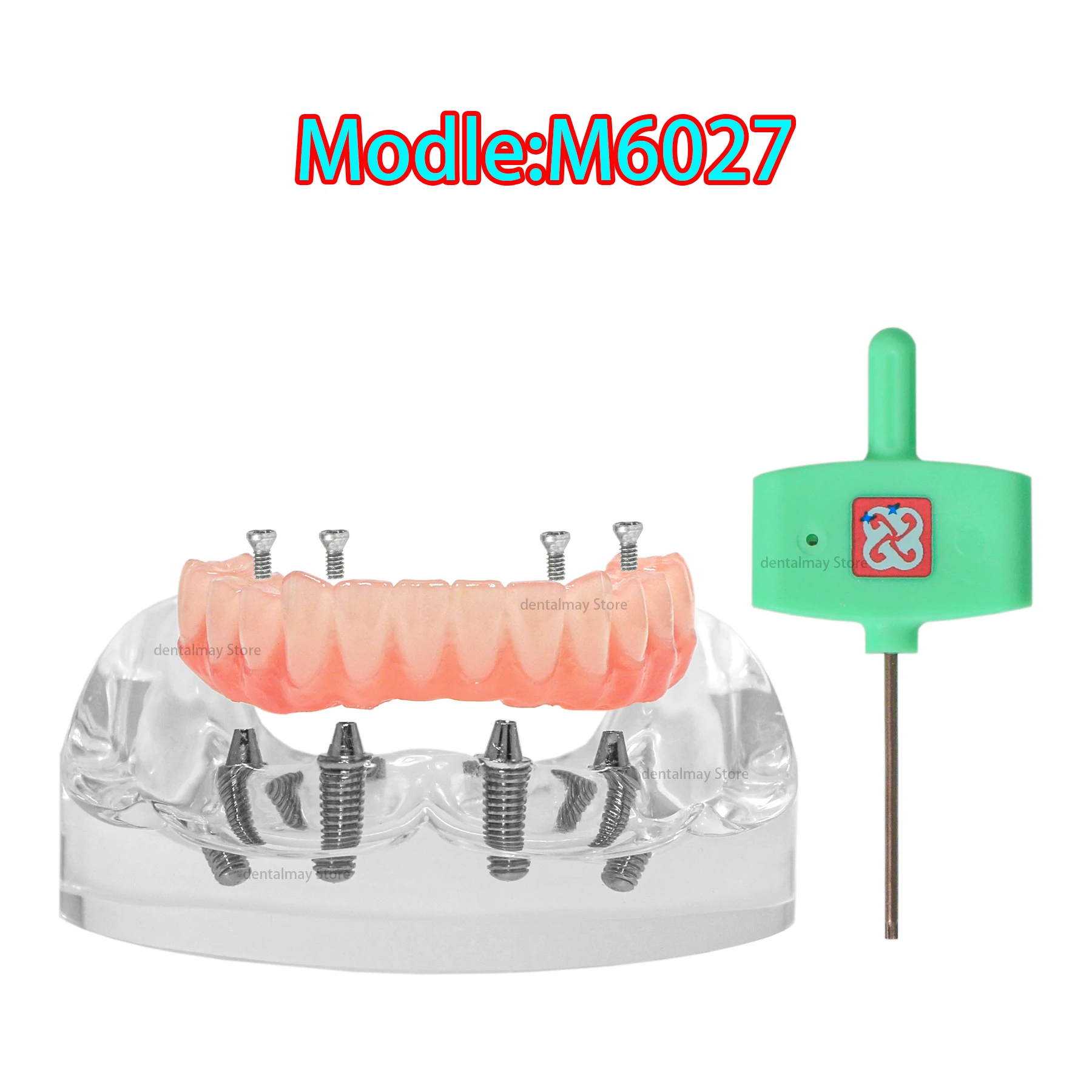 

Dental Lower Jaw Implant Model All-on-4 Overdenture with 4 Screws M6027