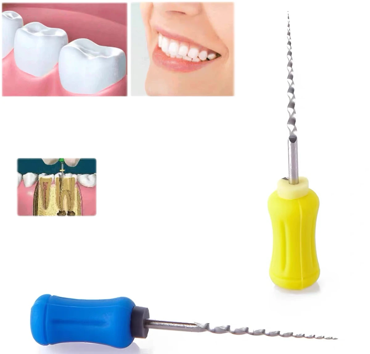 Dental Root Canal Files Hand Use NiTi Endodontic Tools 21mm 25mm 31mm Silicone Handle Root Canal Shaping Cleaning Instruments