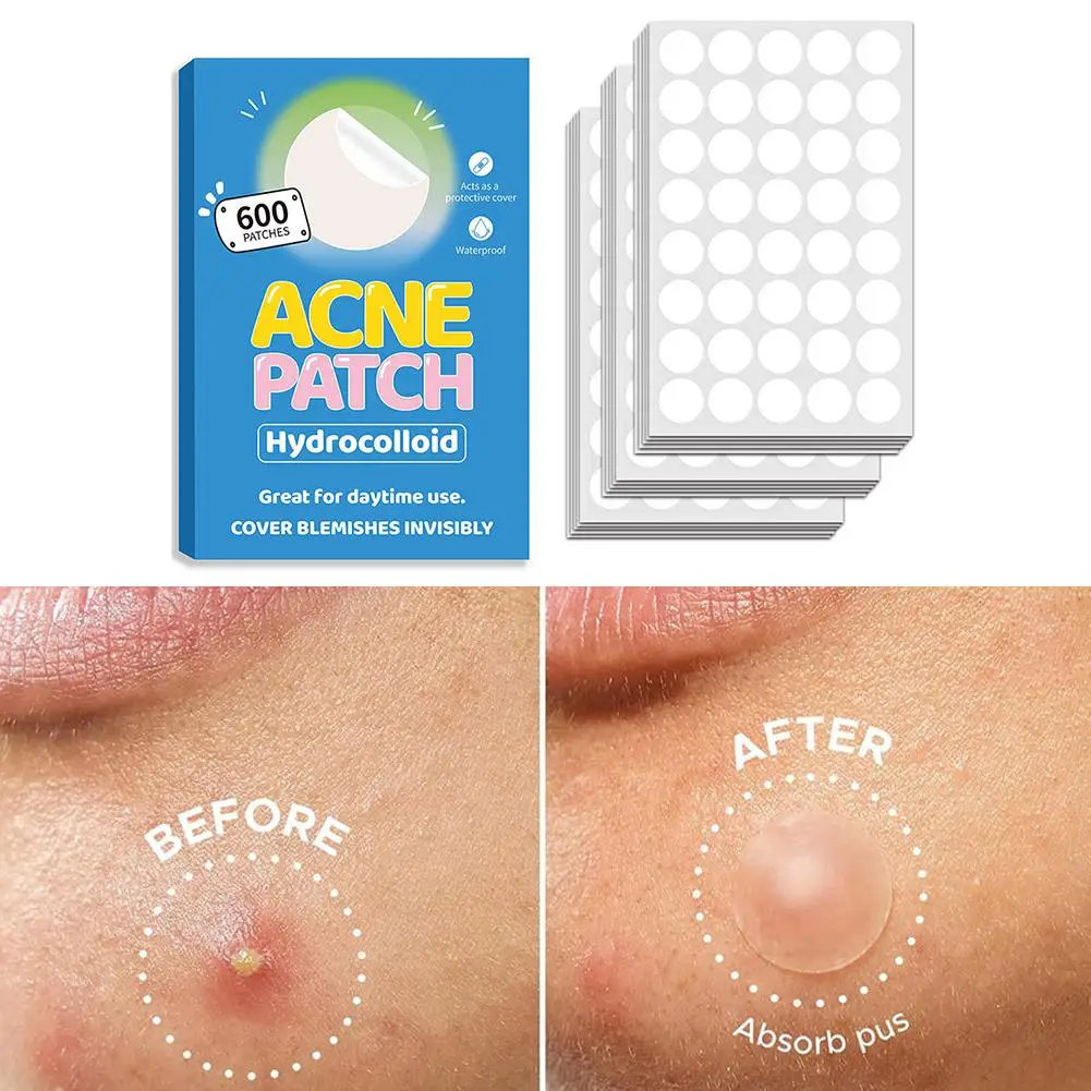 Cerotti idrocolloidi invisibili per coprire le zette e le imperfezioni, cerotti per brufoli dell'acne per adesivi per macchie del viso per tutti i tipi di pelle