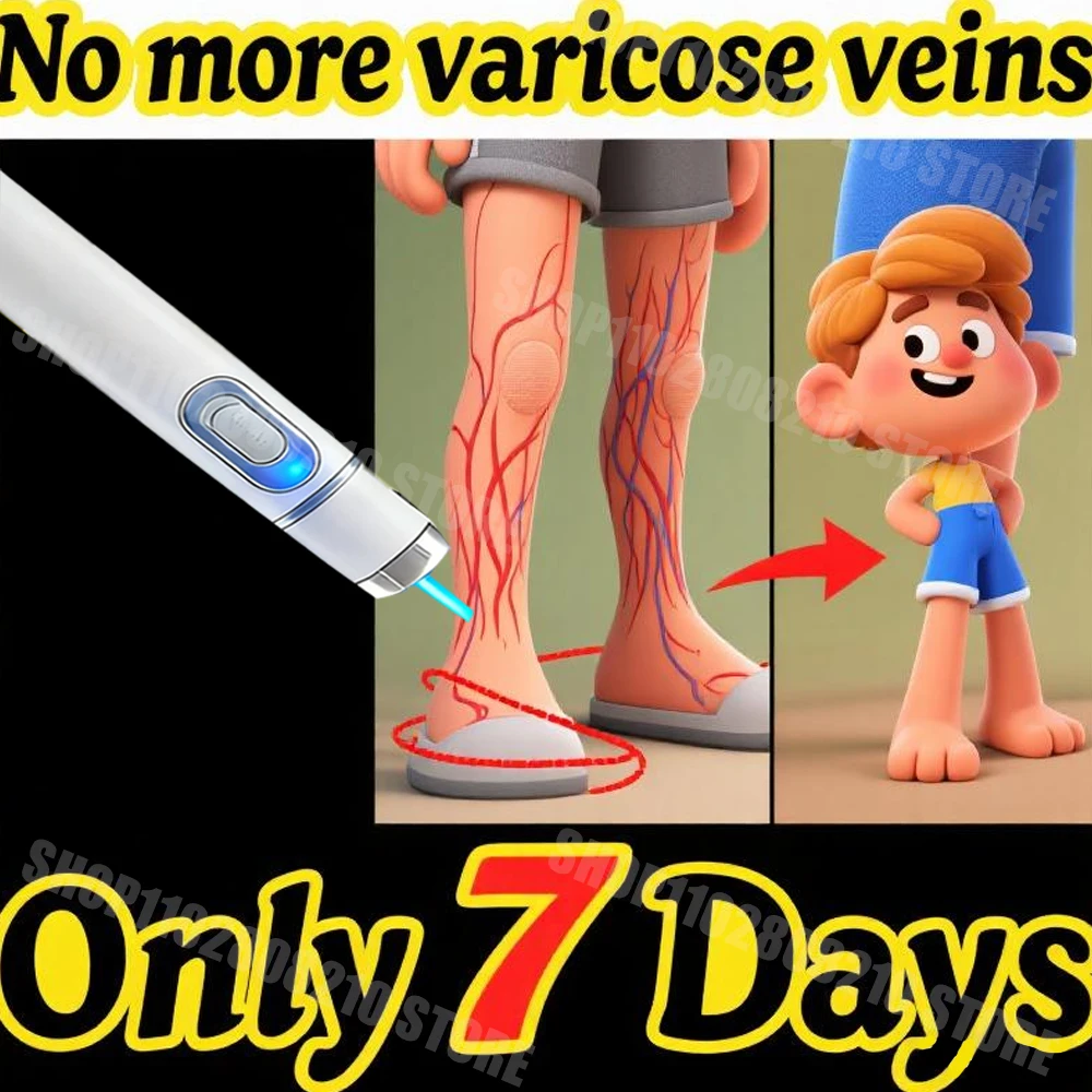 111 Generation Varicose Vein 3nd Laser Pointer Treatment Laser used to treat varicose veins54