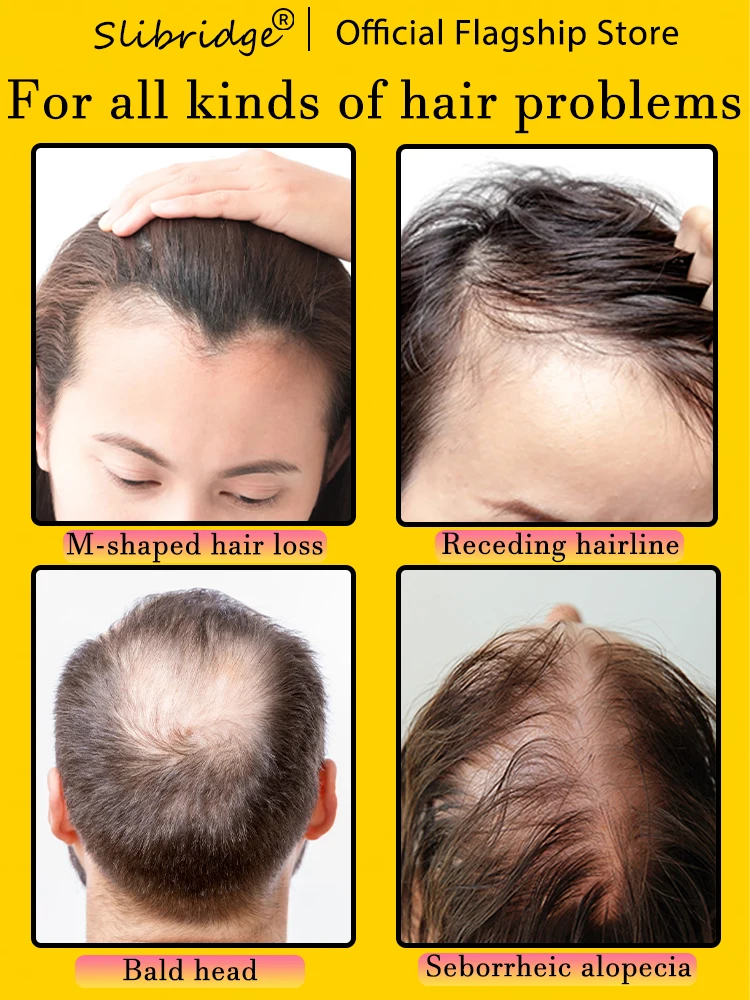 Hot selling product, 99% of buyers buy again, have more and more hair, say goodbye to baldness, thick hair