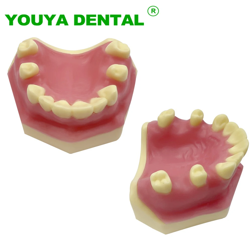 

Dental Teeth Model Implant Practice Typodont Demonstration Tools Dentist Student Studying Teaching Models Dentistry Products